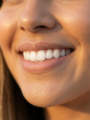 Sonrisa saludable — resultado de tratamiento dental especializado